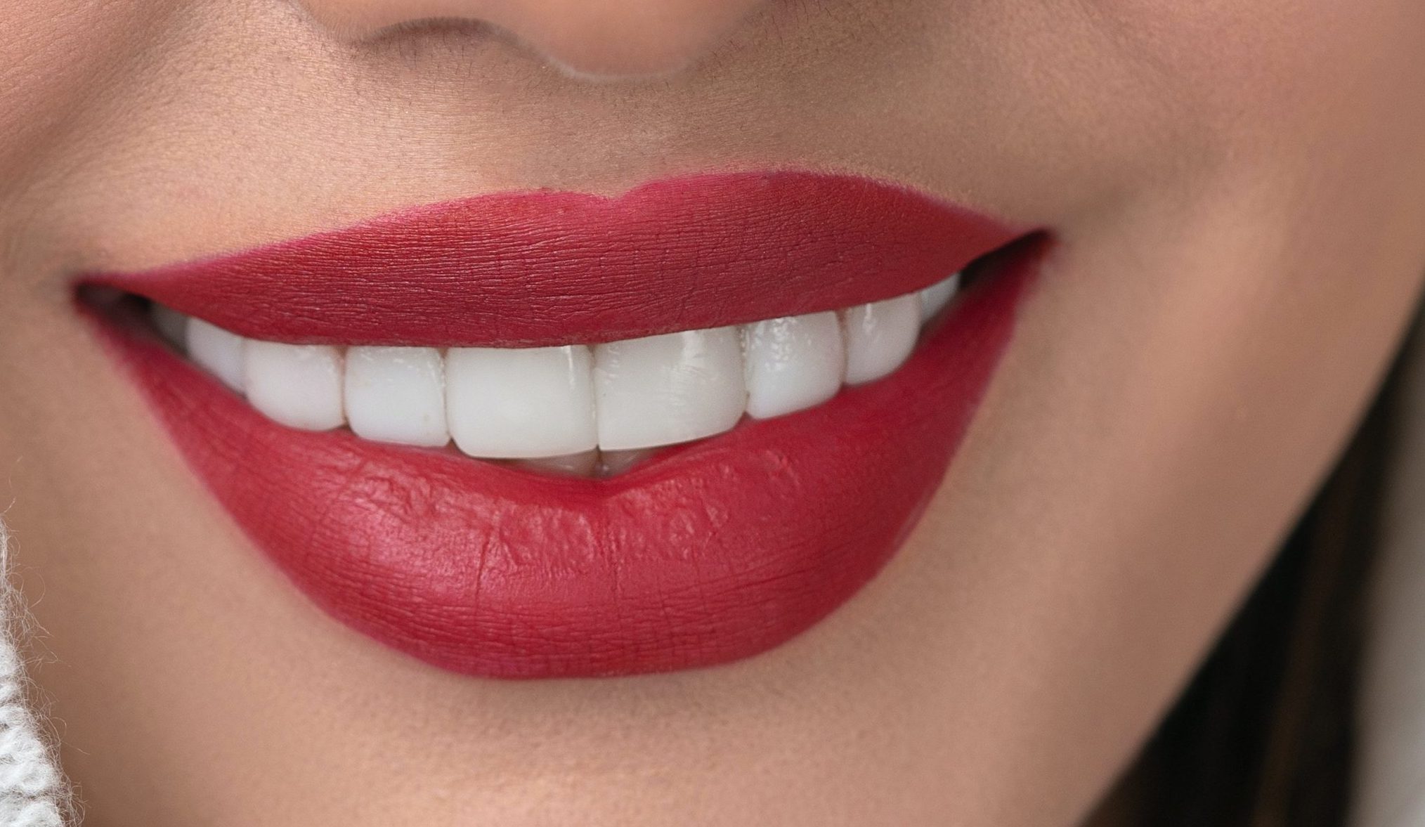 blanqueamiento dental